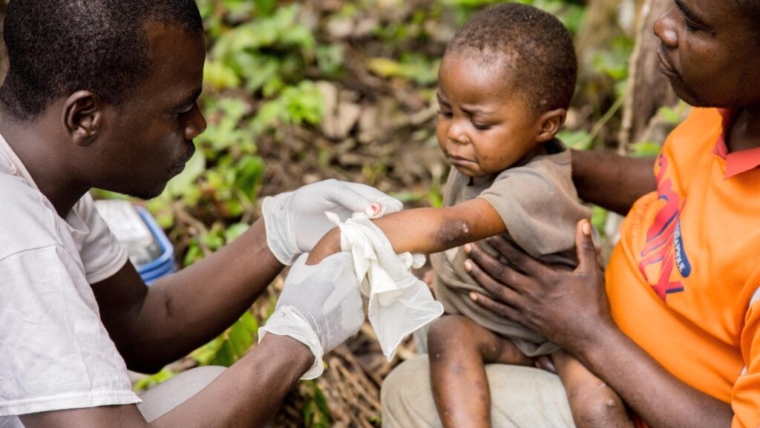 Over 1,000 Deaths Due to Monkeypox in the African Continent